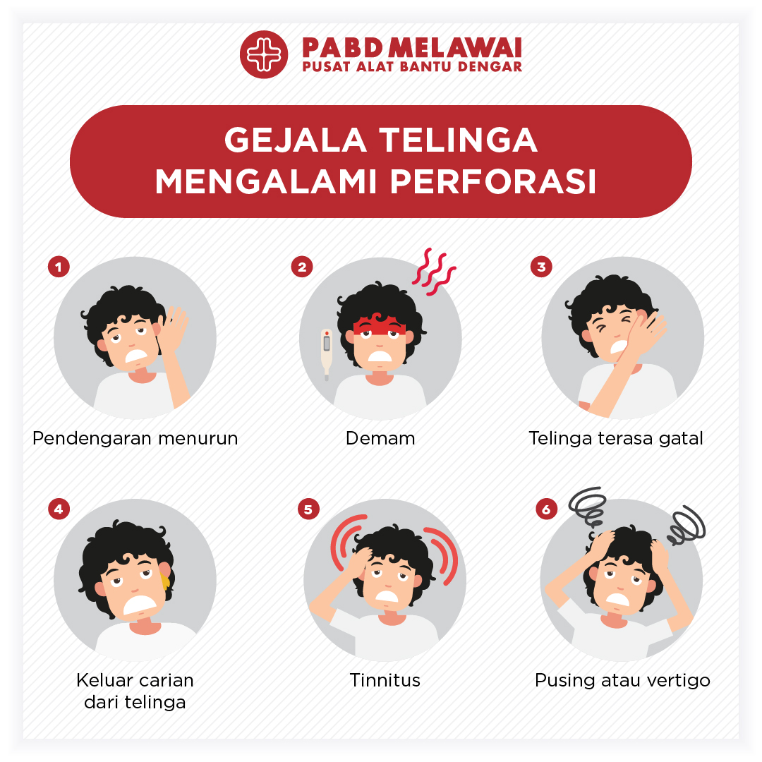 Apa saja sih Gejala-gejala telinga yang mengalami Perforasi?